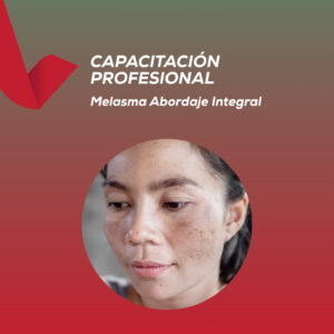 <strong> Melasma Abordaje Integral </strong>